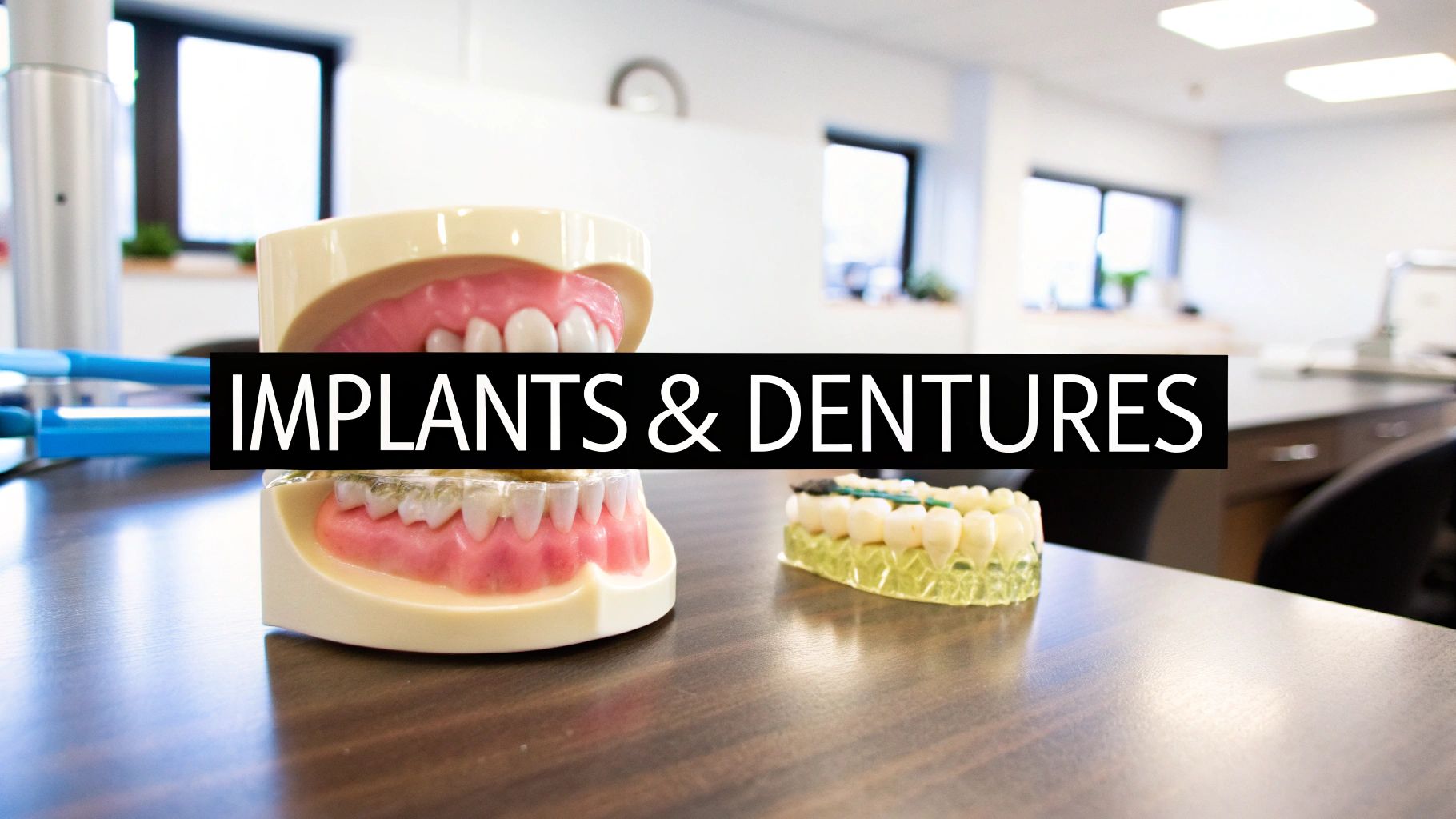 Dental models of implants and dentures displayed on a wooden table in a modern clinic setting.