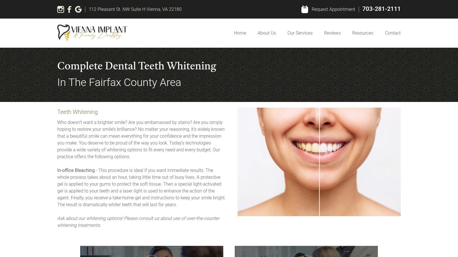Professional teeth whitening procedure at a dental office.
