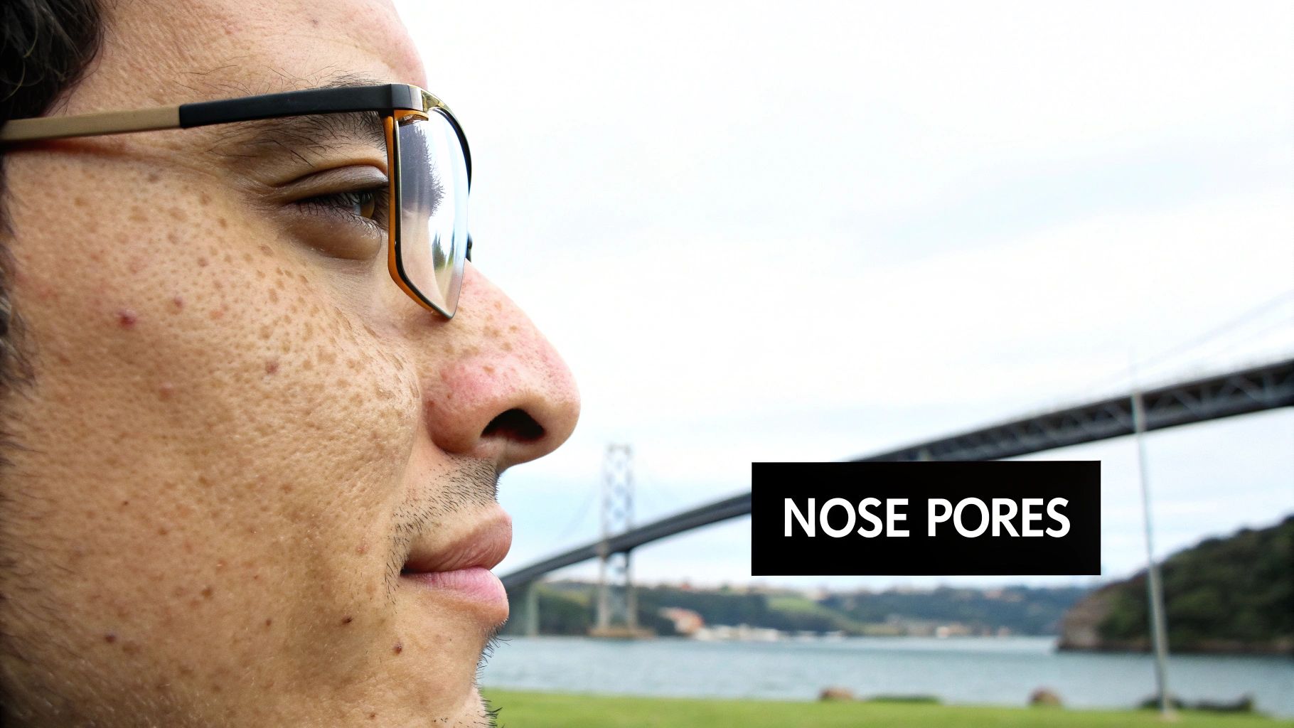 Side profile of a person with glasses, visible nose pores and blemishes, with a bridge in the background. Text 'NOSE PORES'.