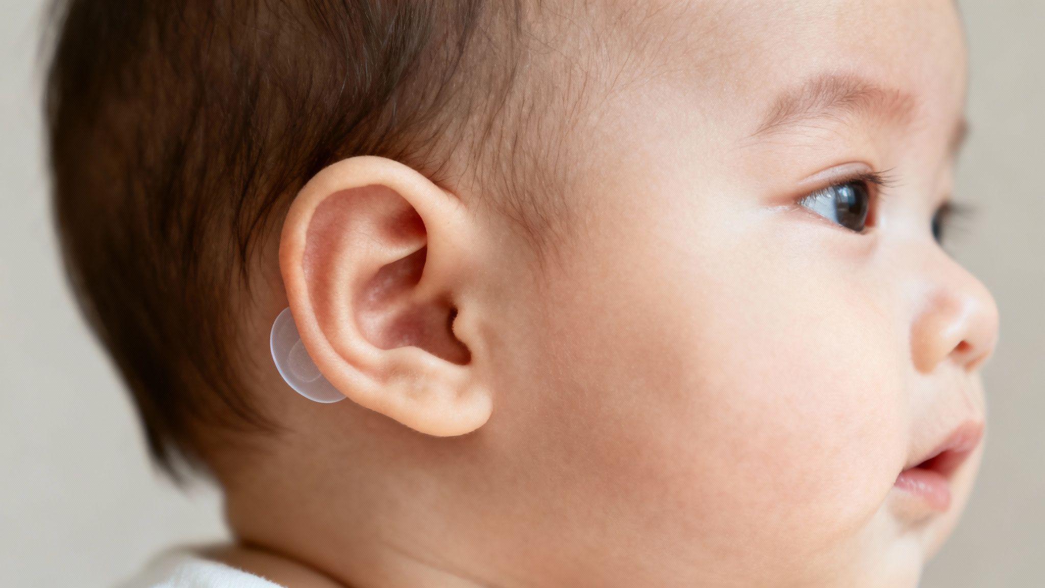 A close-up photo of the transparent EarFix Baby corrector on an infant's ear.