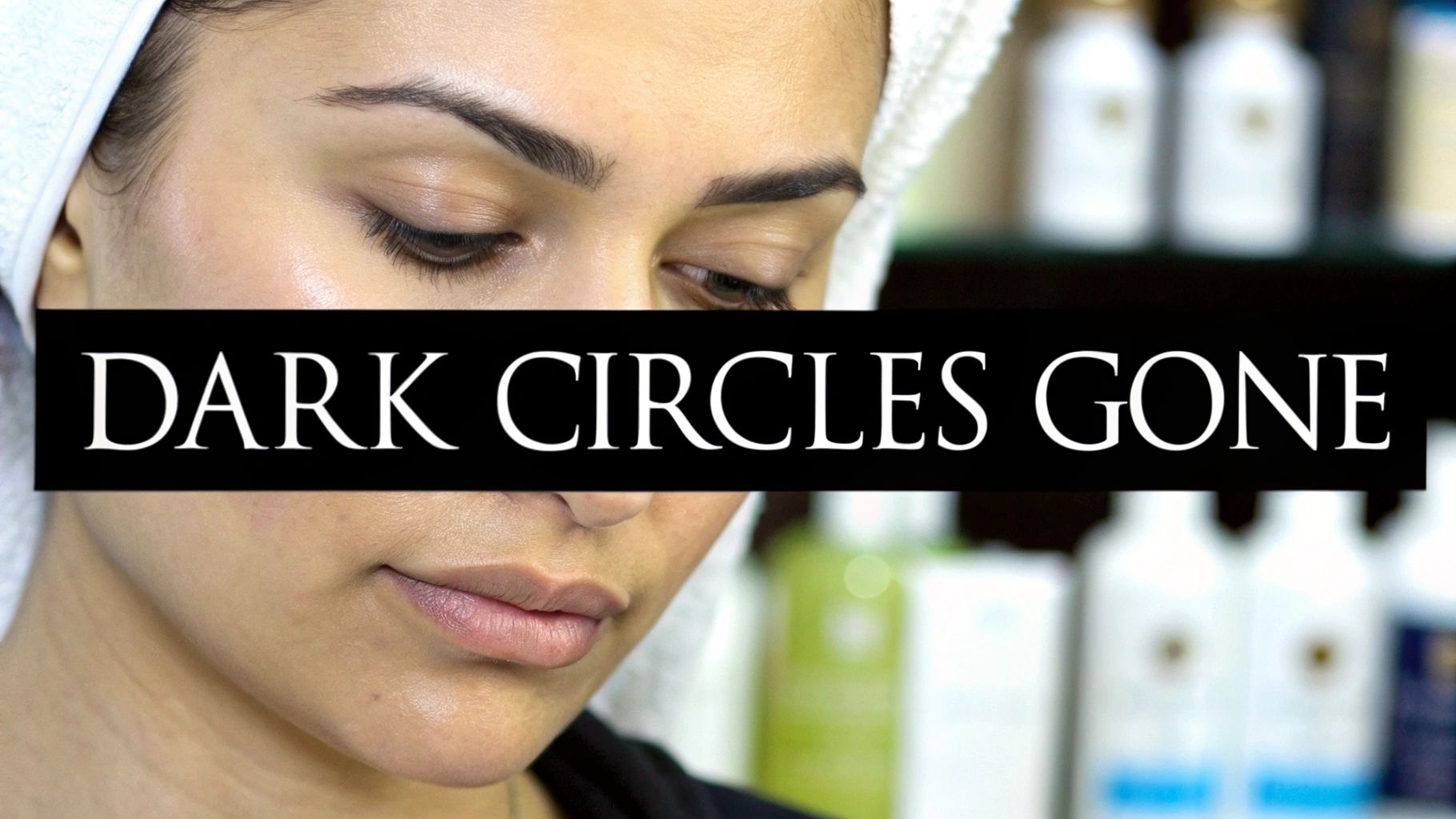 How to Get Rid of Dark Circles for Good