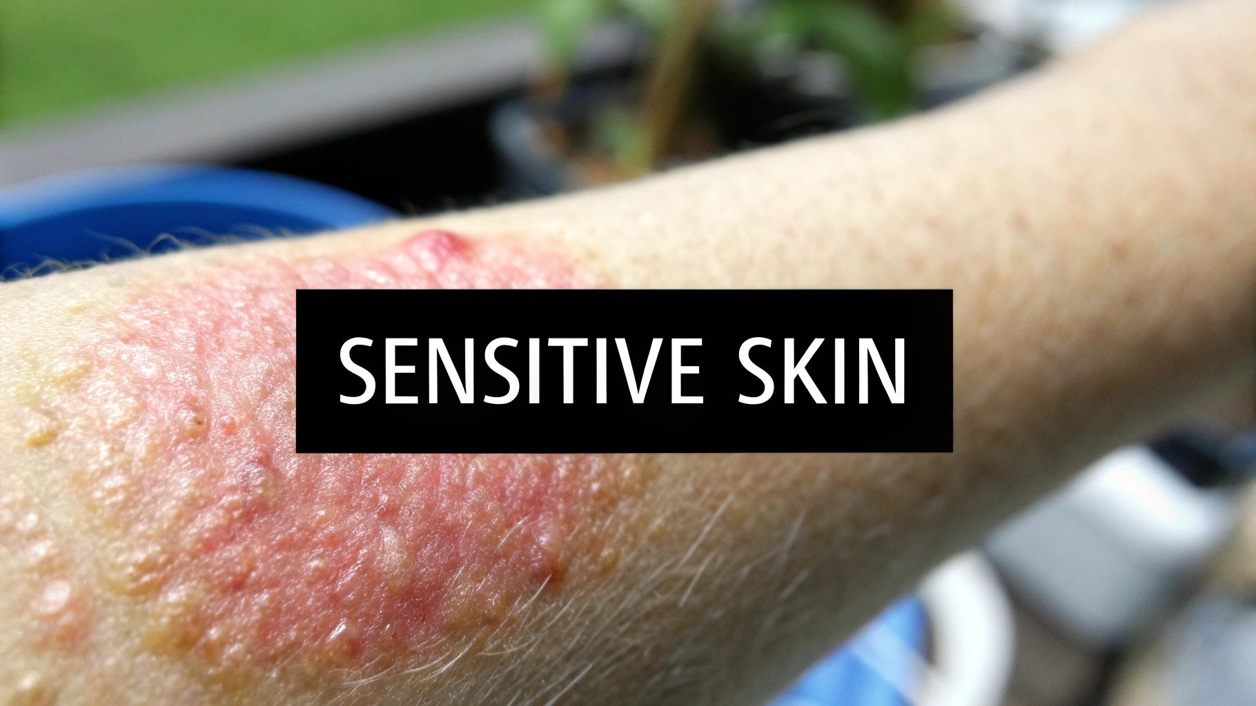 What Causes Skin Sensitivity? A Practical Guide to Finding Calm