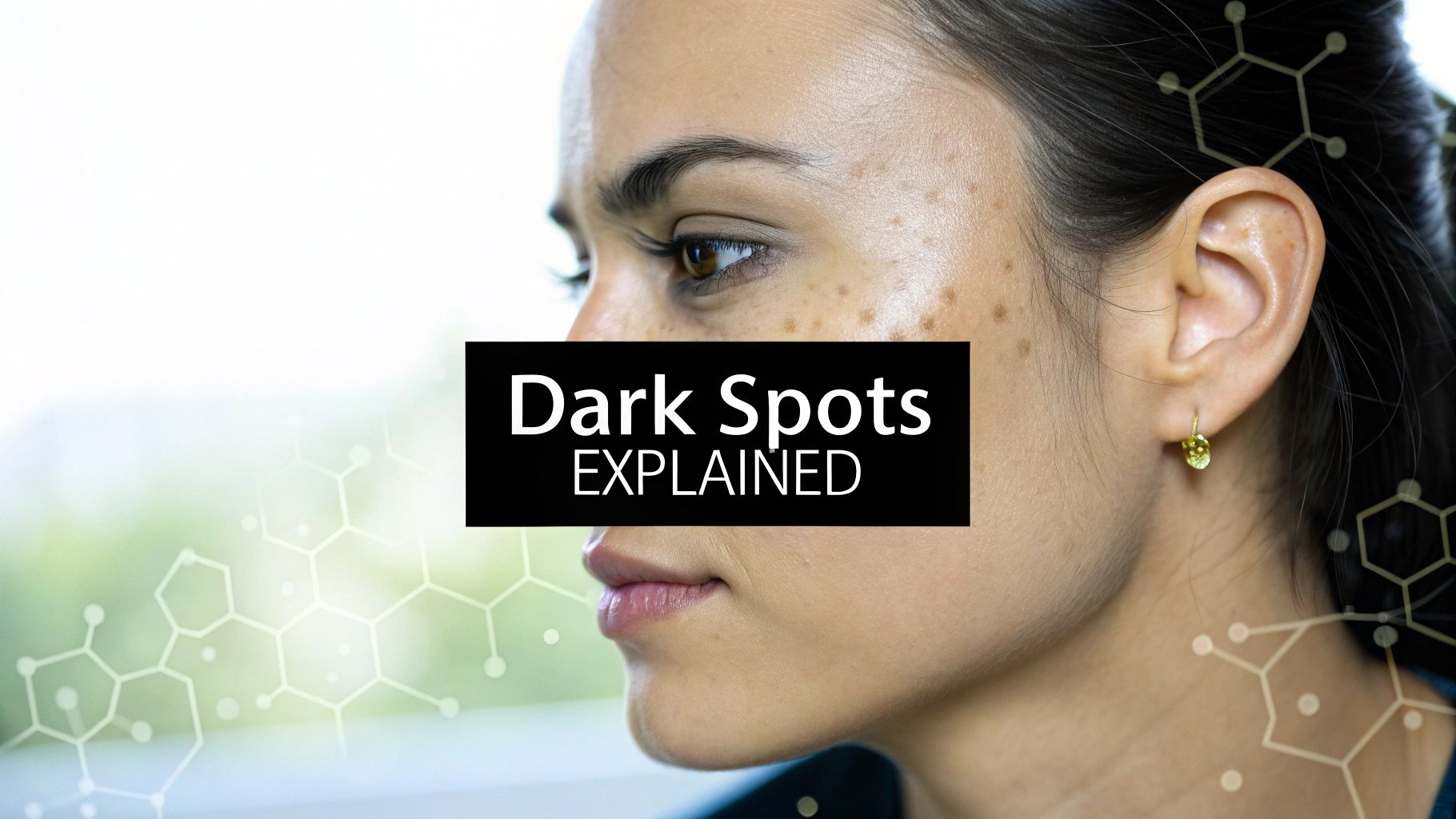 What Causes Hyperpigmentation on Face? Find Out the Reasons