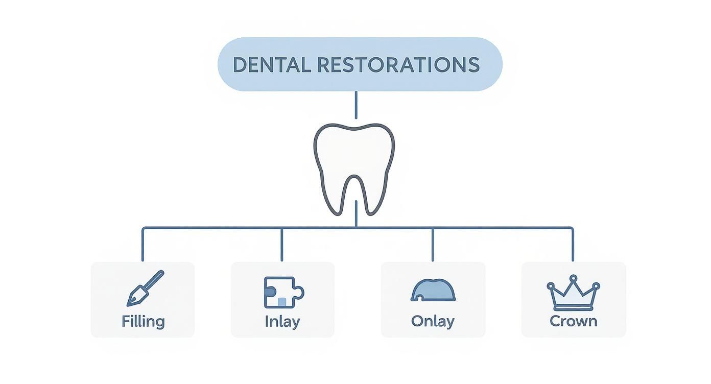 Flowchart illustrating four types of dental restorations: filling, inlay, onlay, and crown.