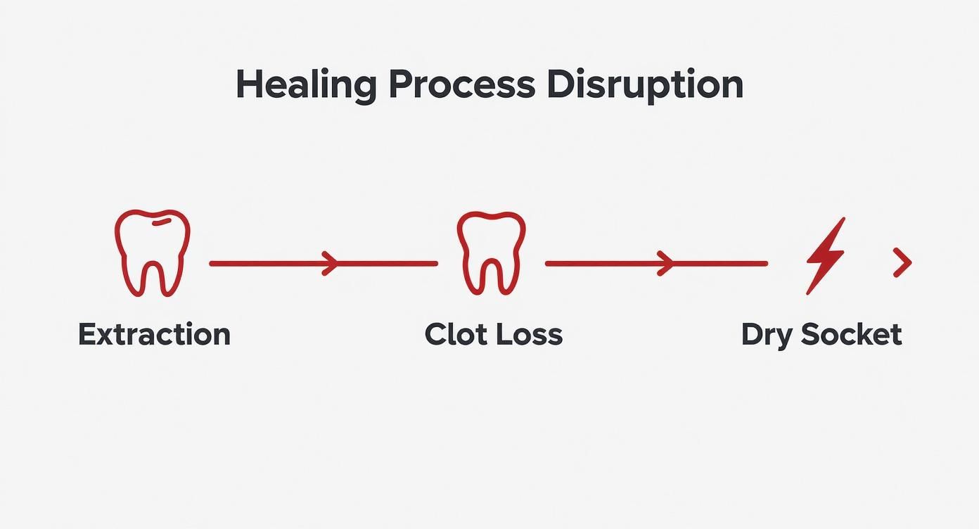 Infographic about dry socket after wisdom teeth removal