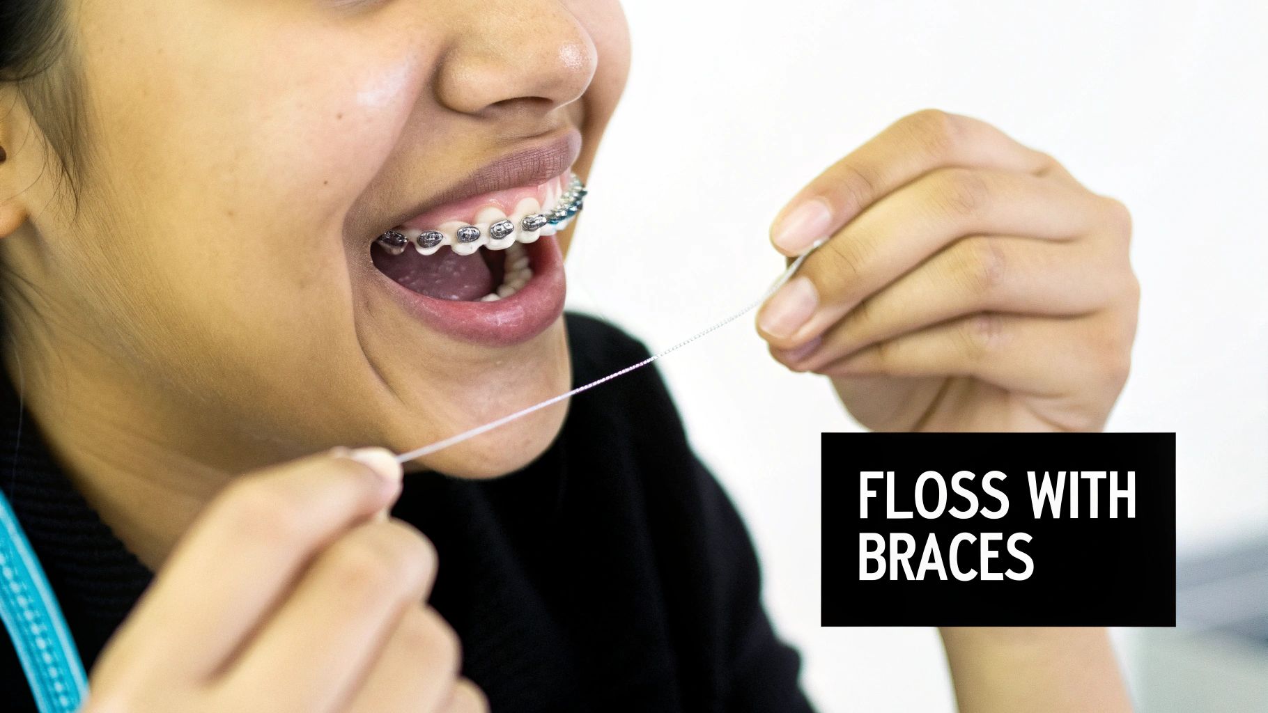 A person with dental braces flossing their teeth, demonstrating proper oral hygiene.