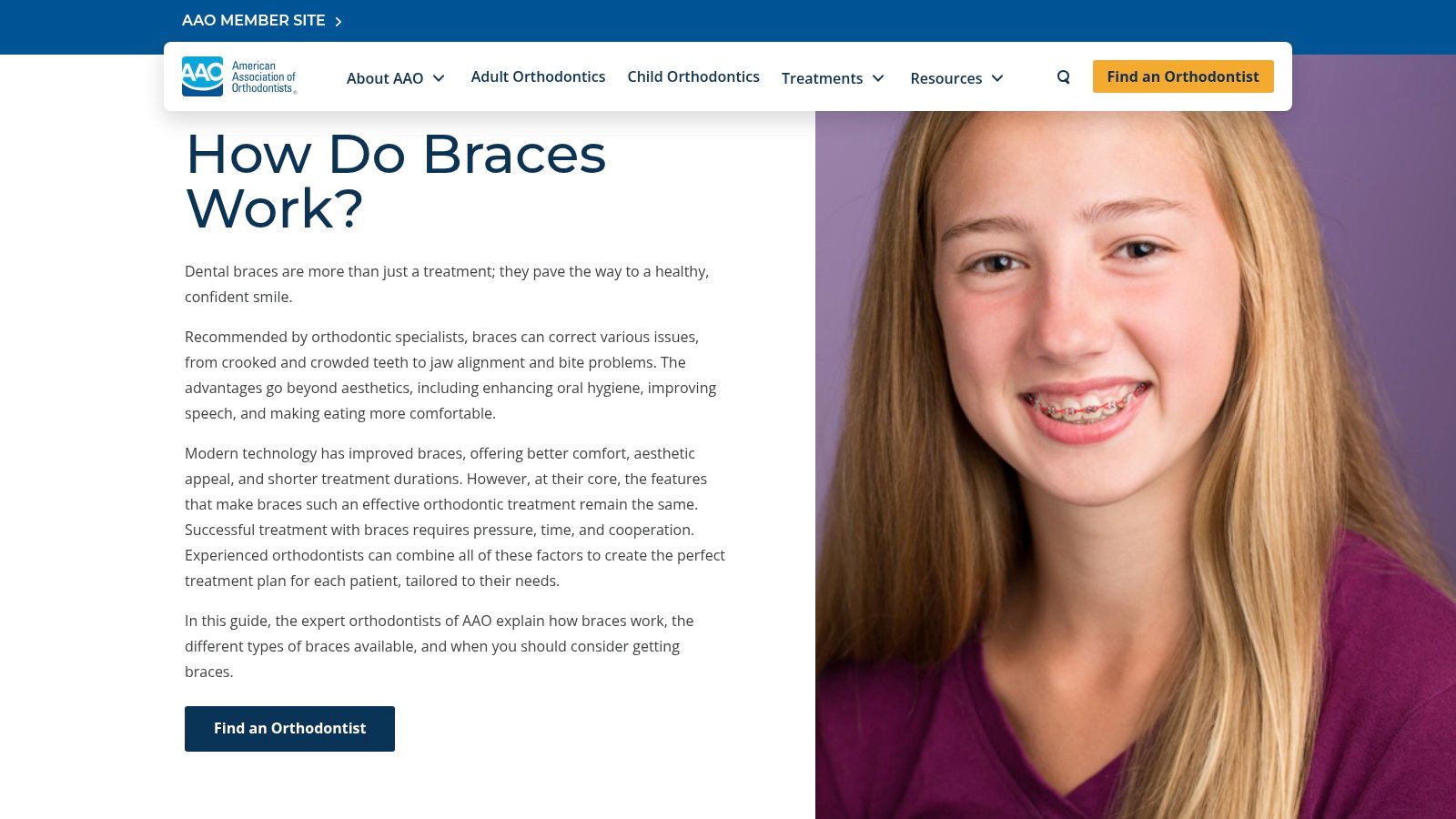 Lingual Braces