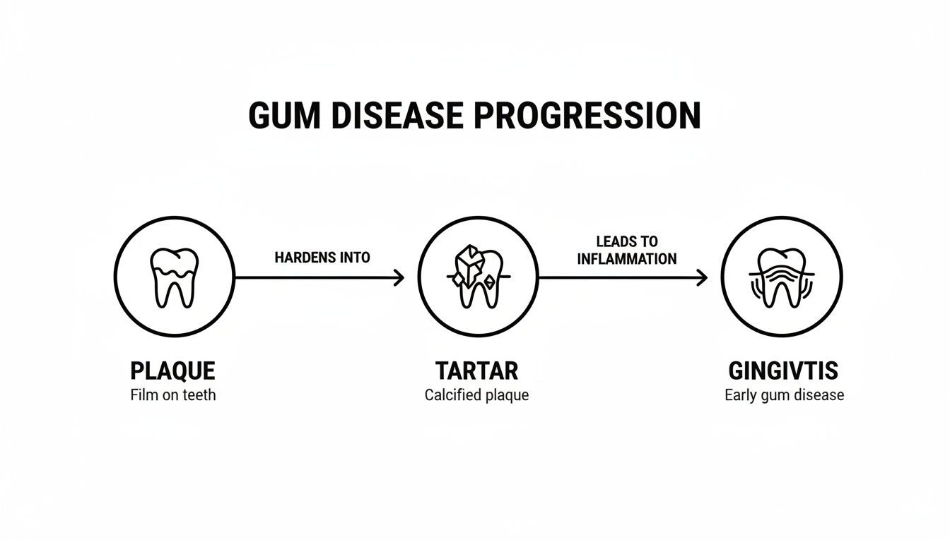 A diagram illustrating the progression of gum disease: plaque hardens into tartar, which leads to gingivitis.