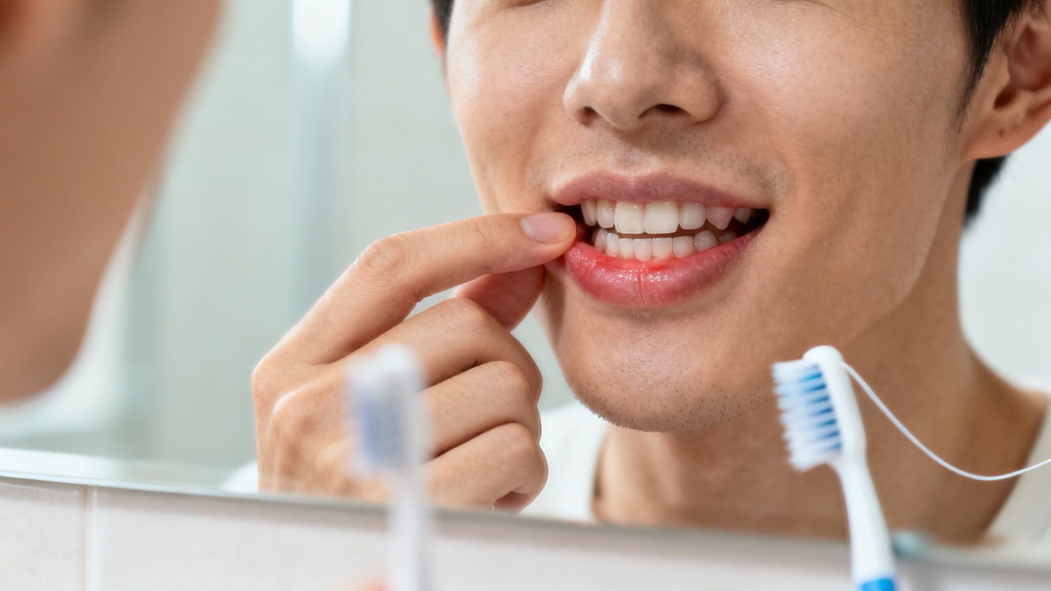 A man in a mirror pulling down his lip to reveal red, inflamed gums, with a toothbrush in view.