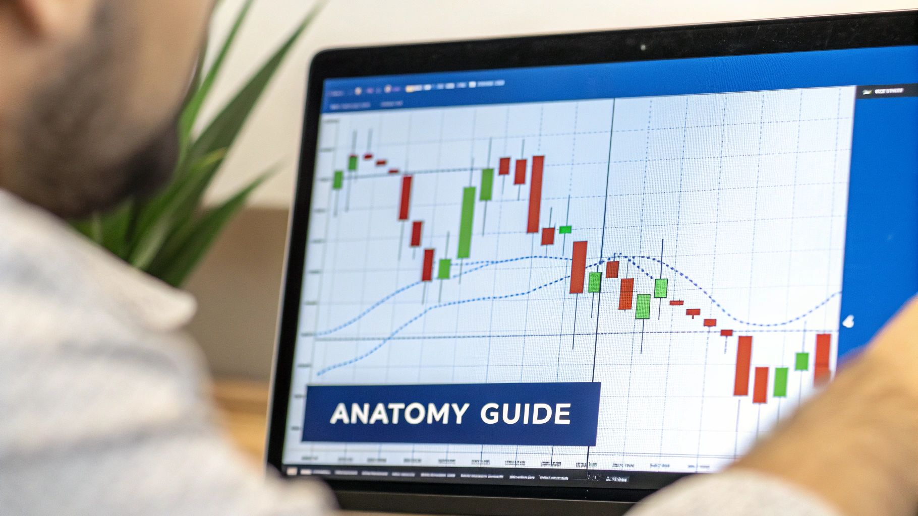 An annotated image of the Hanging Man candlestick pattern, highlighting its small body, long lower shadow, and minimal upper shadow.
