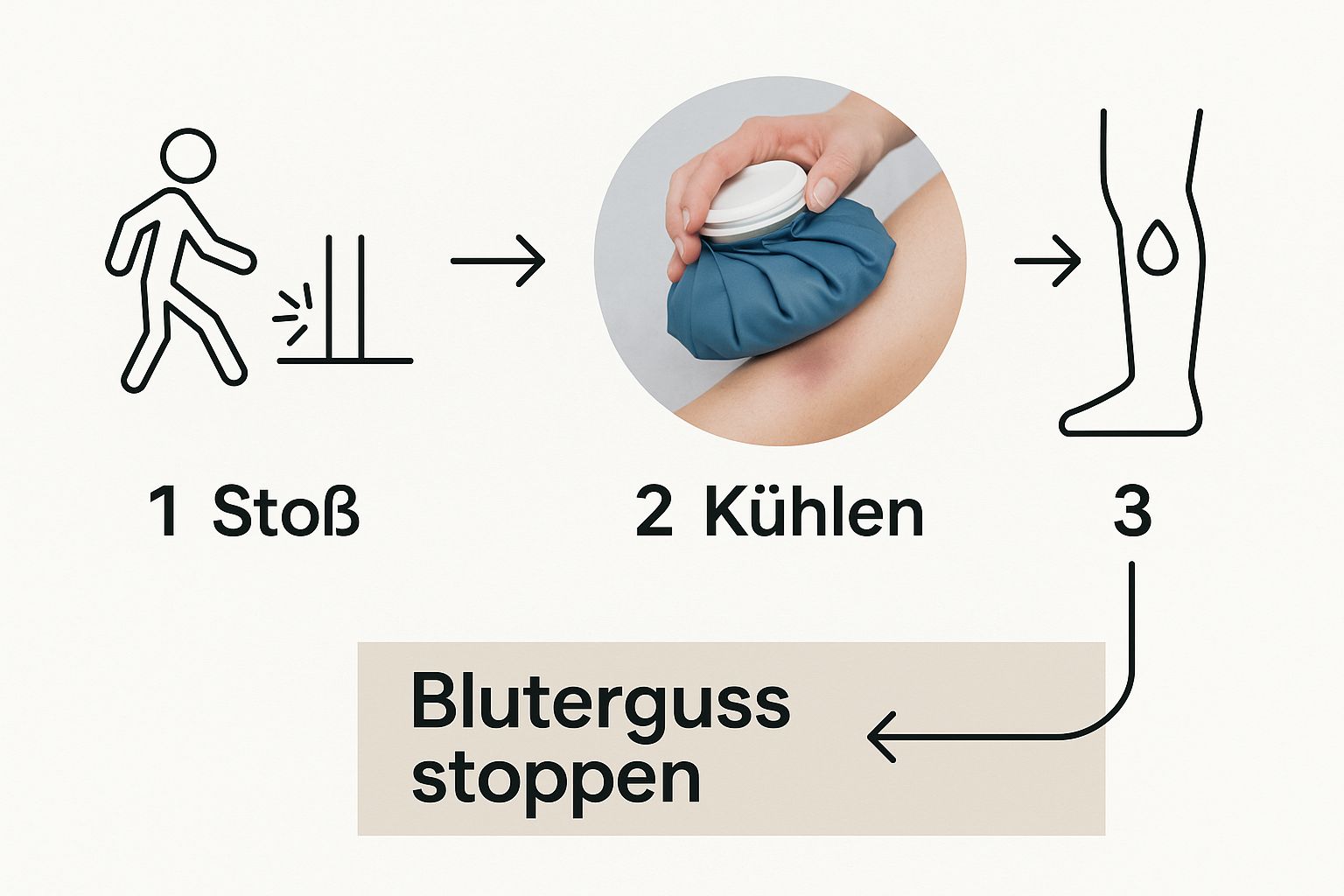 Infografik about was hilft bei bluterguss