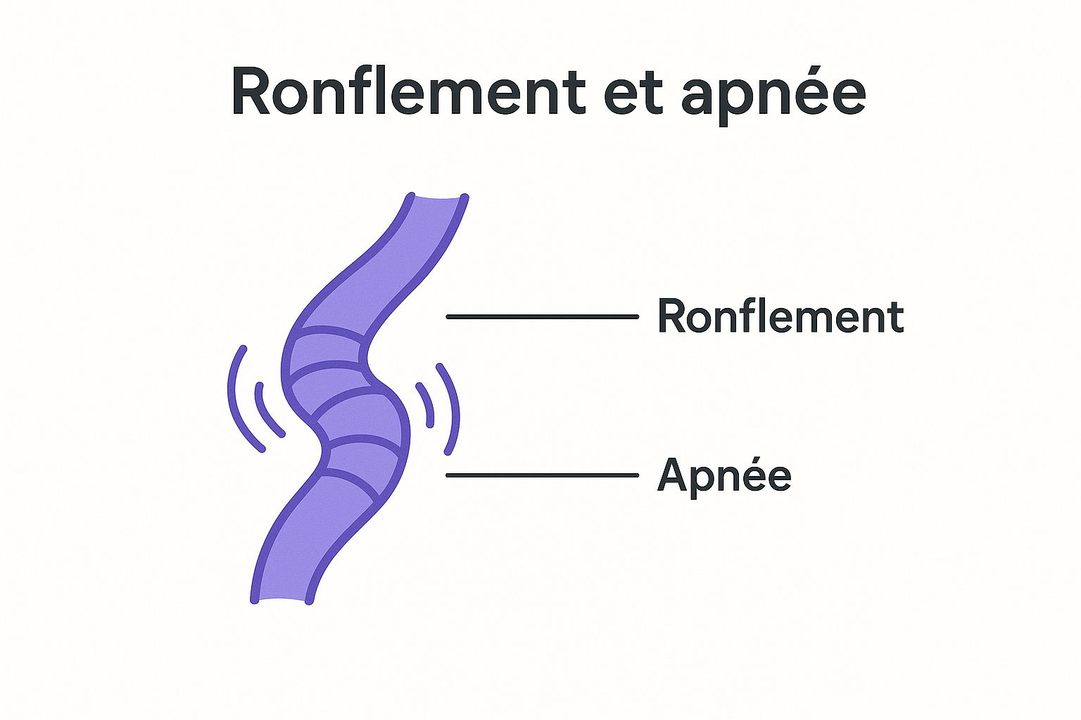 Infographic about appareil anti ronflement et apnée du sommeil