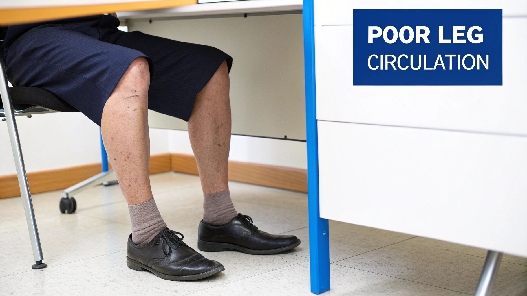 Close-up of a person's legs under a desk showing visible signs of poor leg circulation.