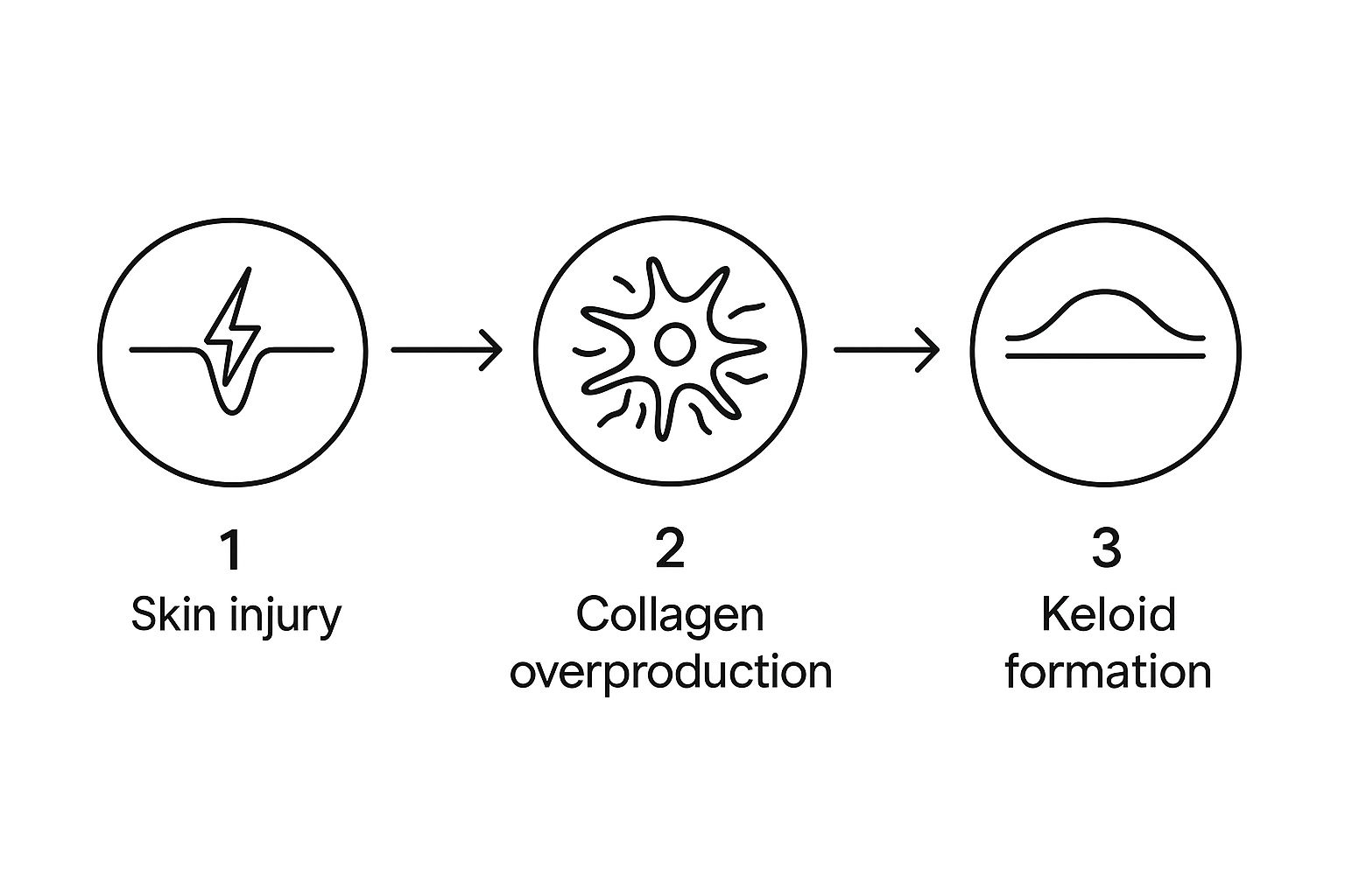 Diagram of keloid formation in three steps: 1. Skin injury, 2. Collagen overproduction, 3. Keloid formation, with arrows between each.