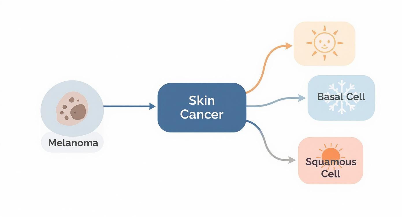 Flowchart illustrating different types of skin cancer: Melanoma, Basal Cell, and Squamous Cell.