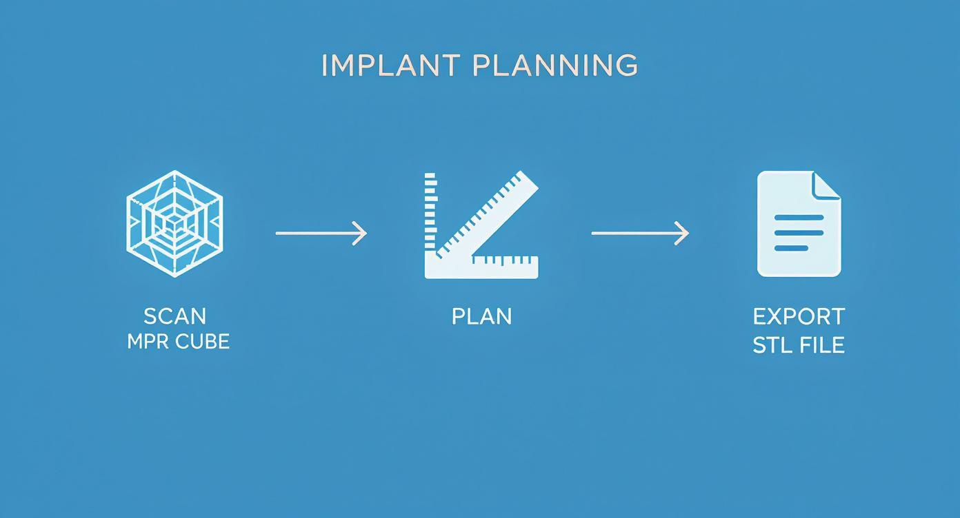 A flowchart illustrating the steps of implant planning: scan MPR cube, plan, and export STL file.