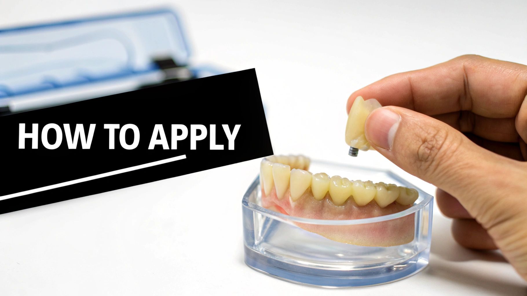 Hand holding a dental implant crown with a screw over a tooth model, illustrating how to apply.