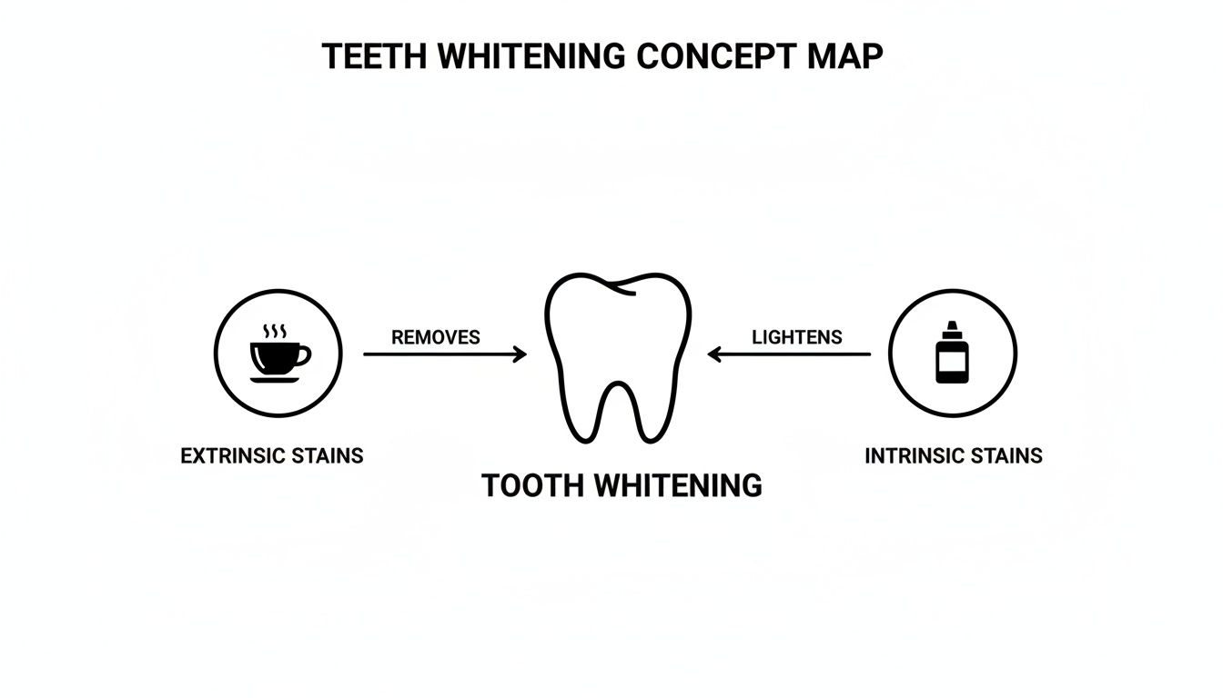 A concept map illustrating teeth whitening, showing it removes extrinsic stains and lightens intrinsic stains.