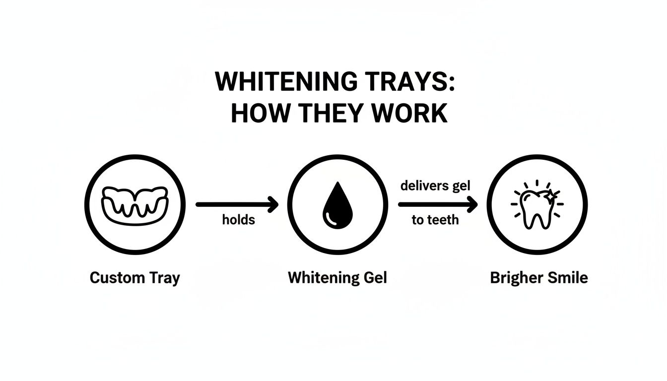 Diagram showing how custom trays hold whitening gel to whiten teeth for a brighter smile.
