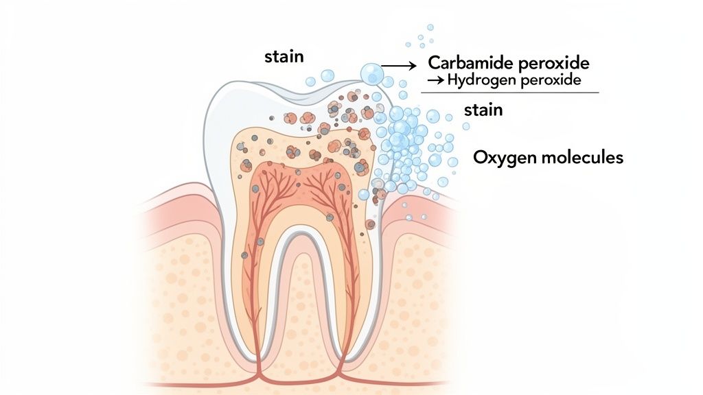 An illustration showing carbamide peroxide breaking down tooth stains with oxygen molecules for whitening.