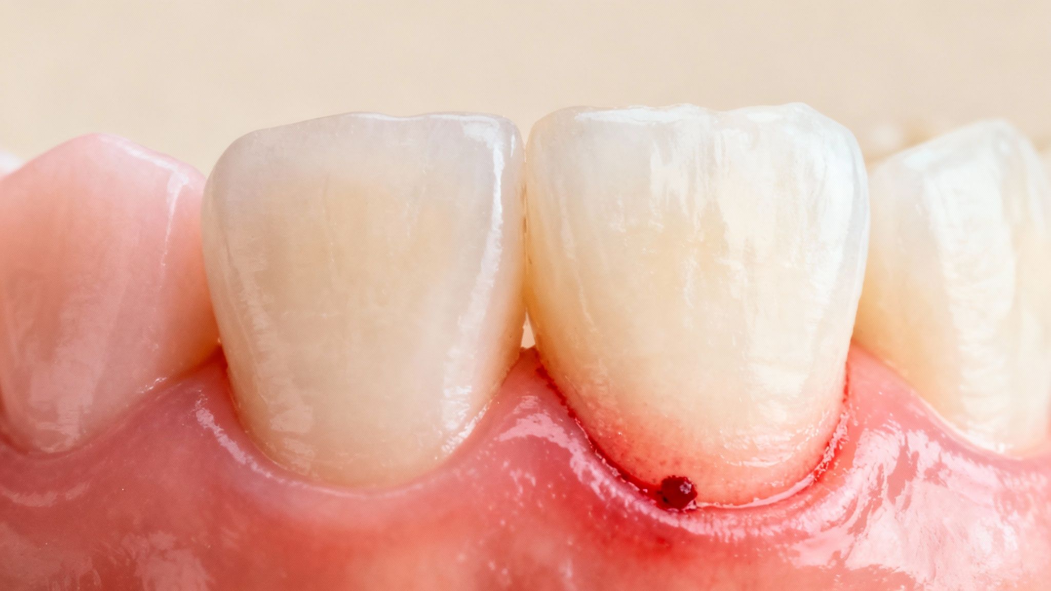 Close-up of a person's smile showing their teeth and gums