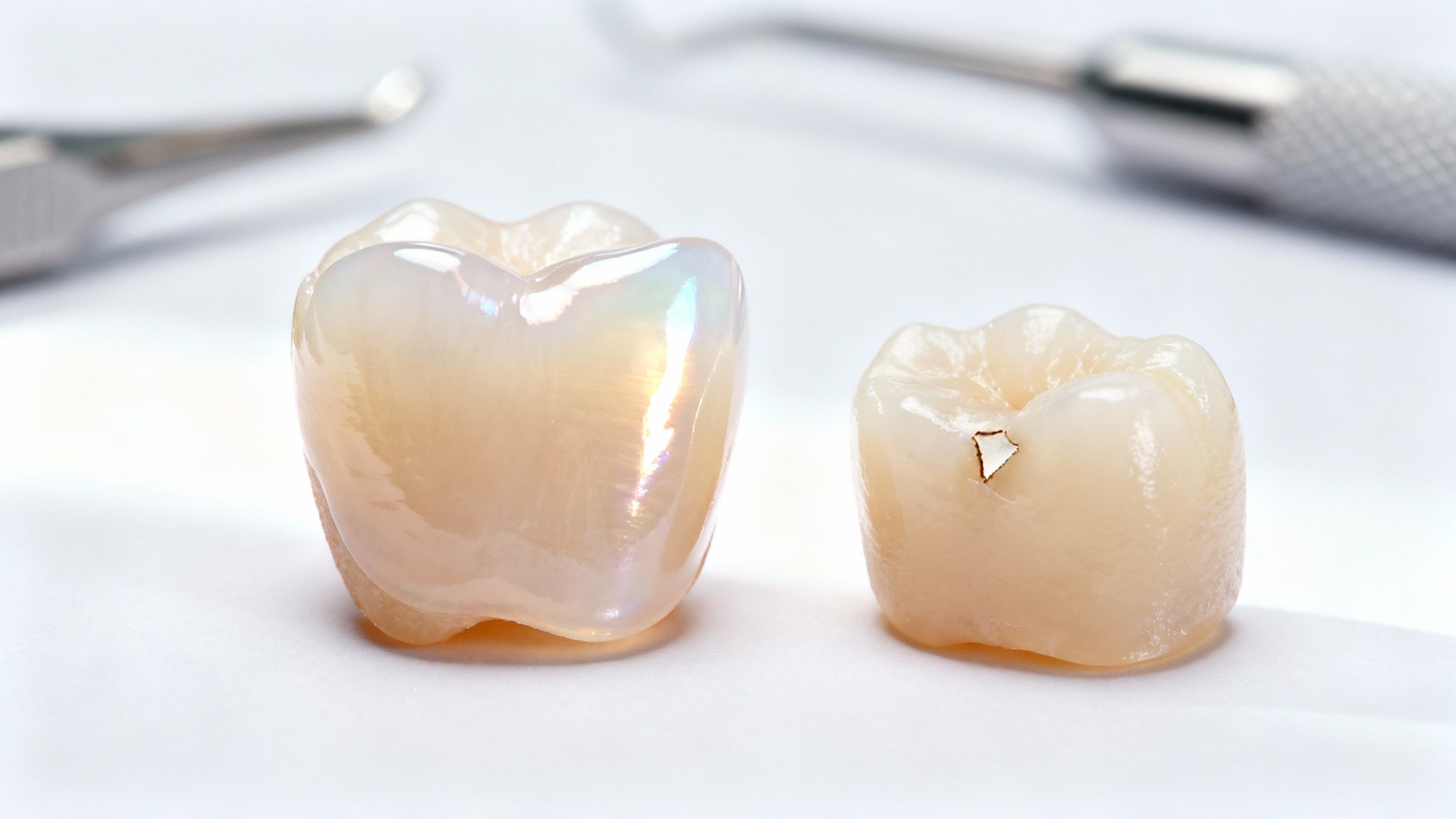 San Diego patient admiring their new porcelain veneers after a successful cosmetic dental procedure.