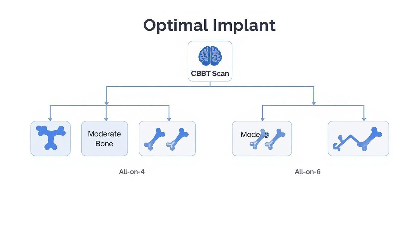 Flowchart for optimal dental implant selection based on CBCT scan, detailing All-on-4 and All-on-6 options.