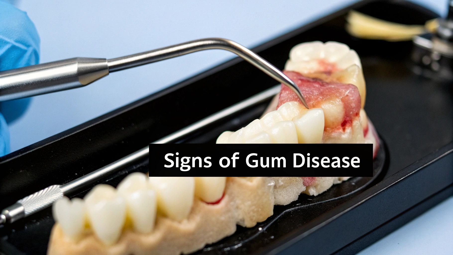 Gum Disease and Heart Health: The Hidden Link – Protect Both at Trust Dental Care in Tijuana 46 Image