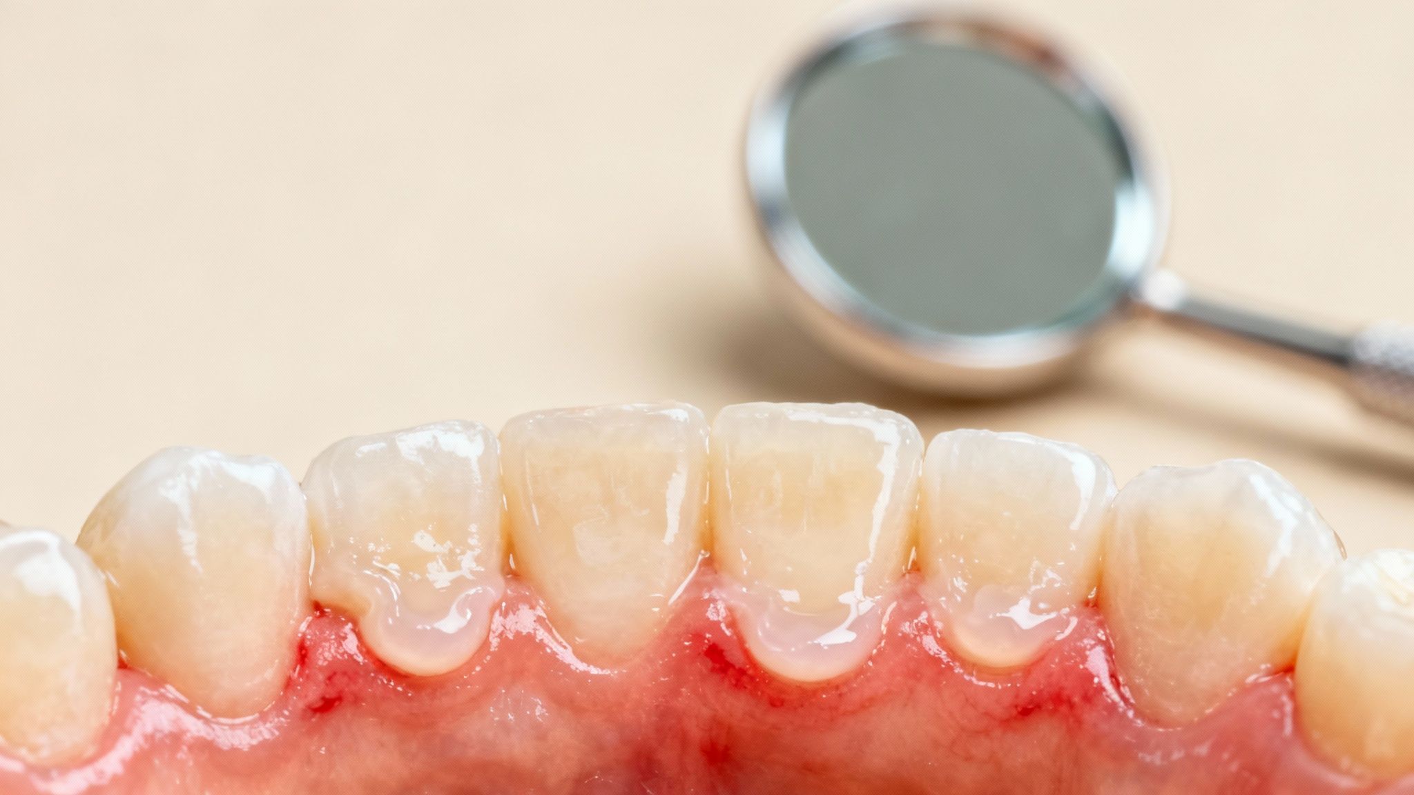 Dental model showing healthy teeth and gums with magnifying glass for oral examination