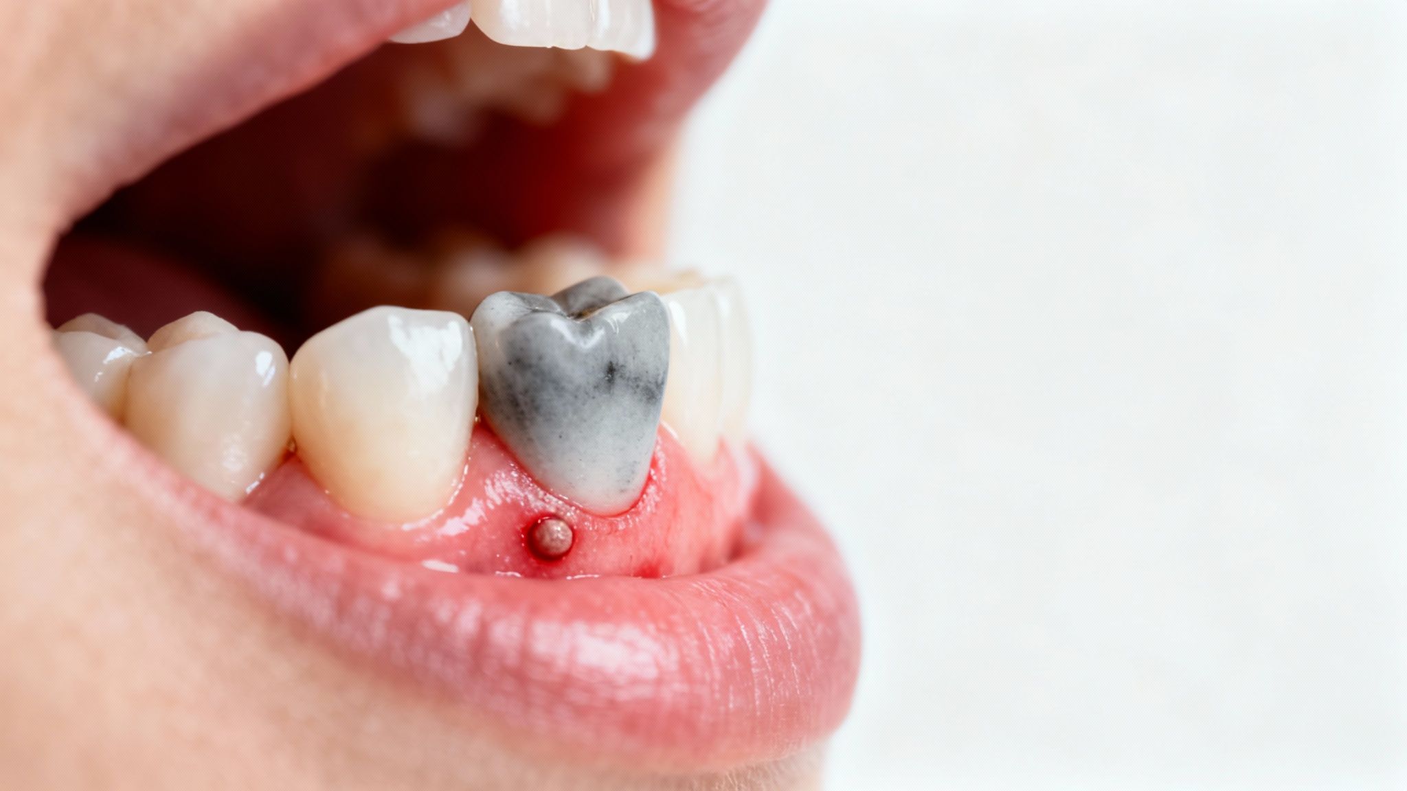 Person holding their jaw due to a strange taste in their mouth.