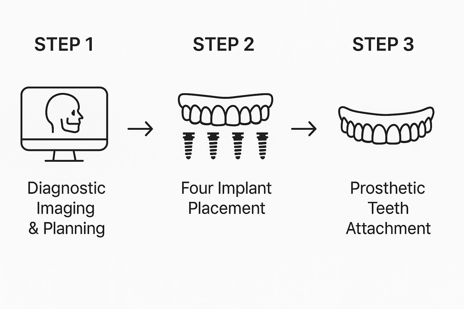 All On 4 Dental Implants Tijuana: A Guide To Your New Smile by a Top Tijuana & Mexico Dentist 51 Image
