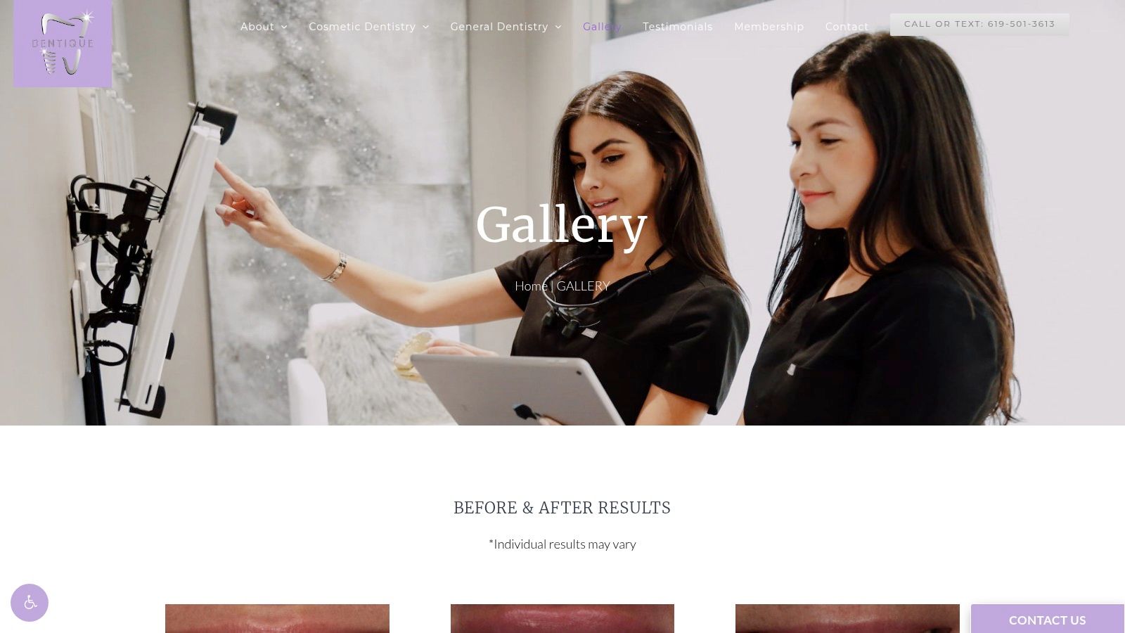 Dentique San Diego (Cosmetic gallery)