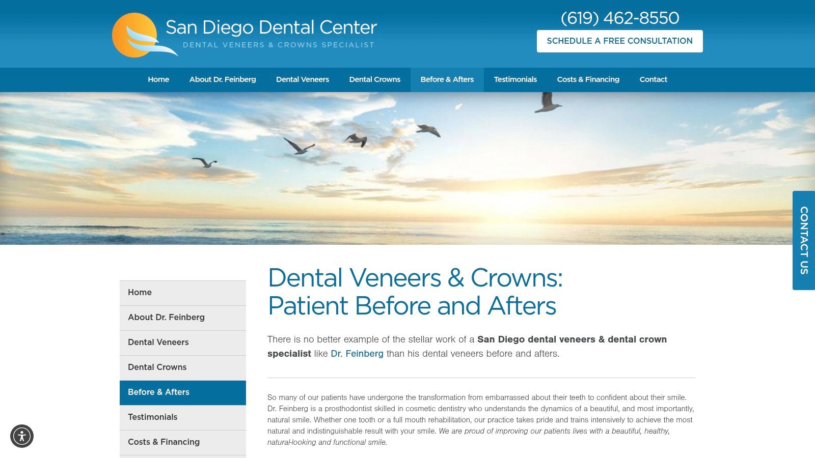VeneersSanDiego.com — Veneer & Crown Specialist