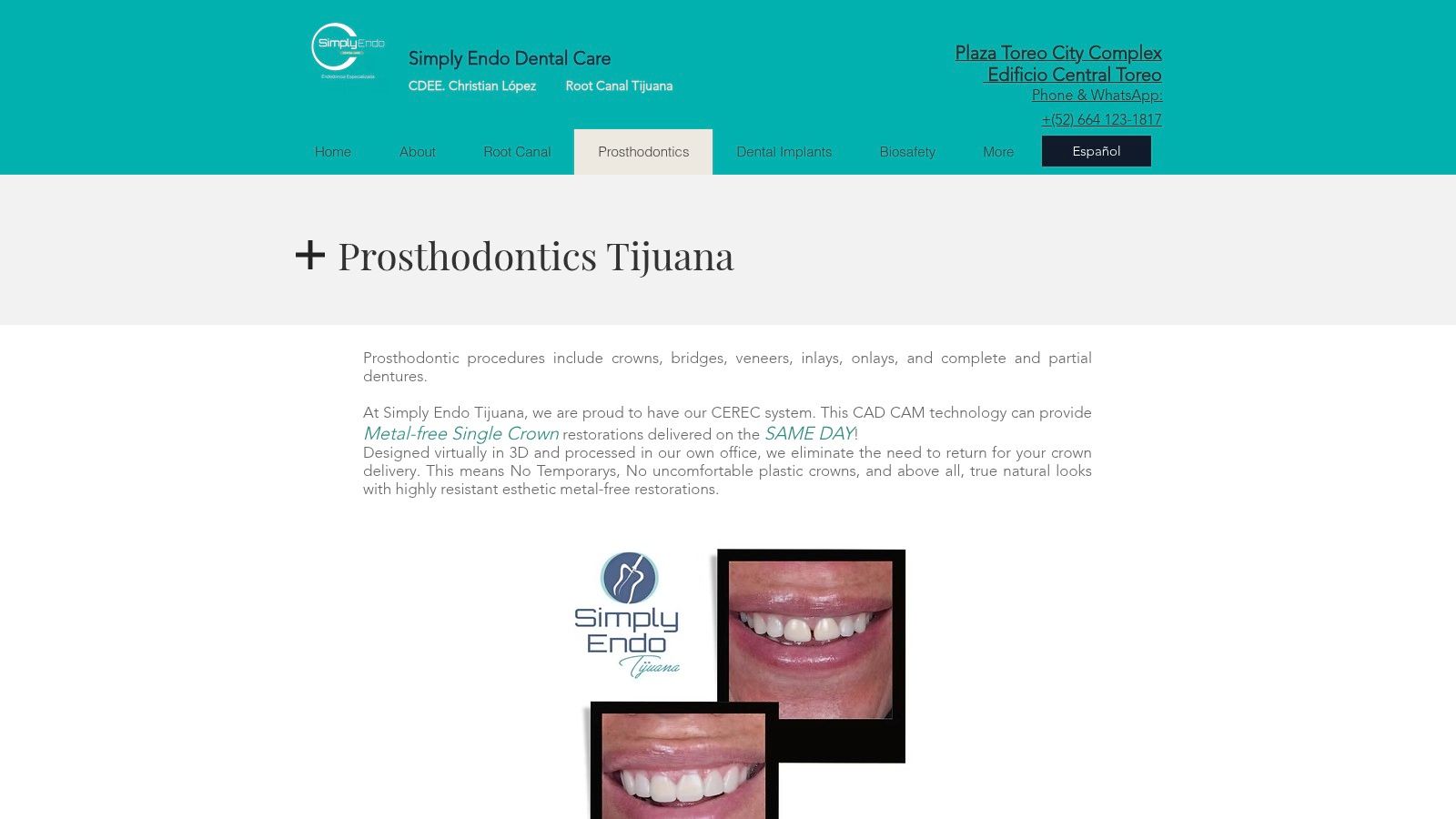 Simply Endo Tijuana (Prosthodontics/CEREC)