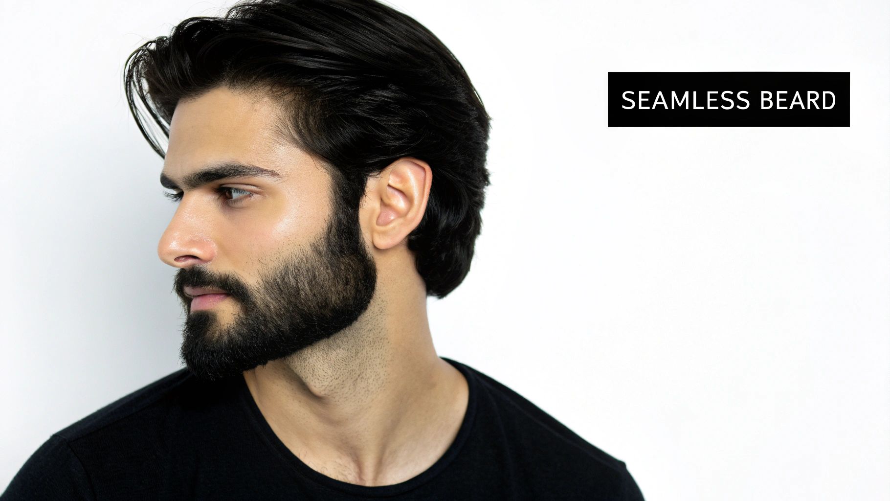 Hairline Integration Beard Design
