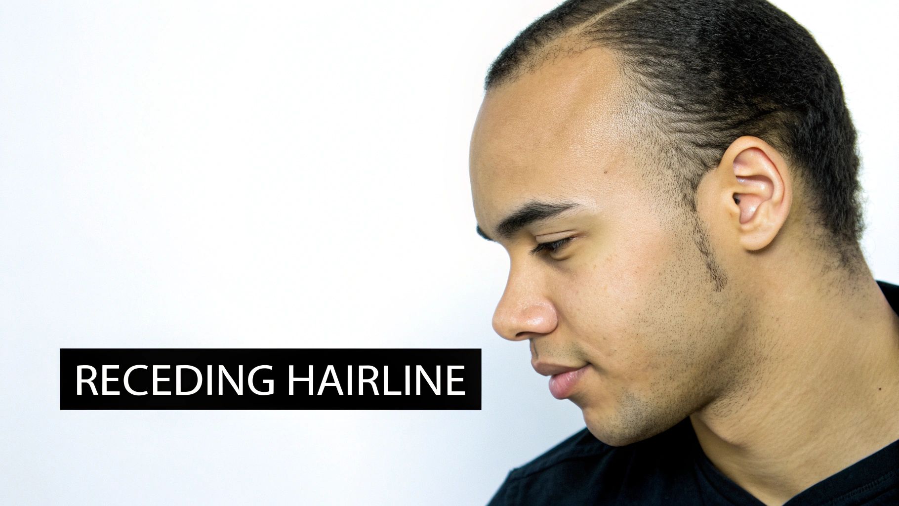 An SMP artist consulting with a client, pointing to different hairline styles on a chart.