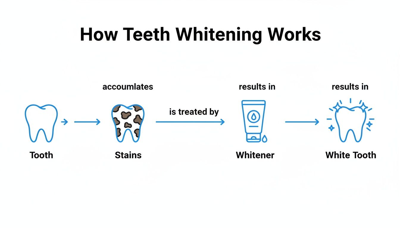 Flowchart illustrating how teeth whitening works, from a clean tooth to a white tooth.