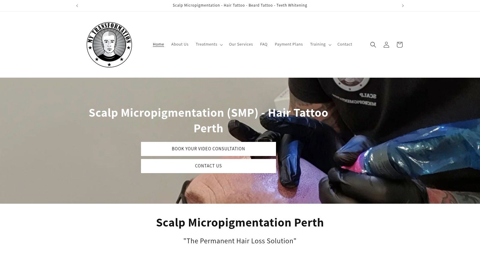 Case Study 1: Recreating the 'Buzz Cut' Look for Advanced Male Pattern Baldness (My Transformation, WA)