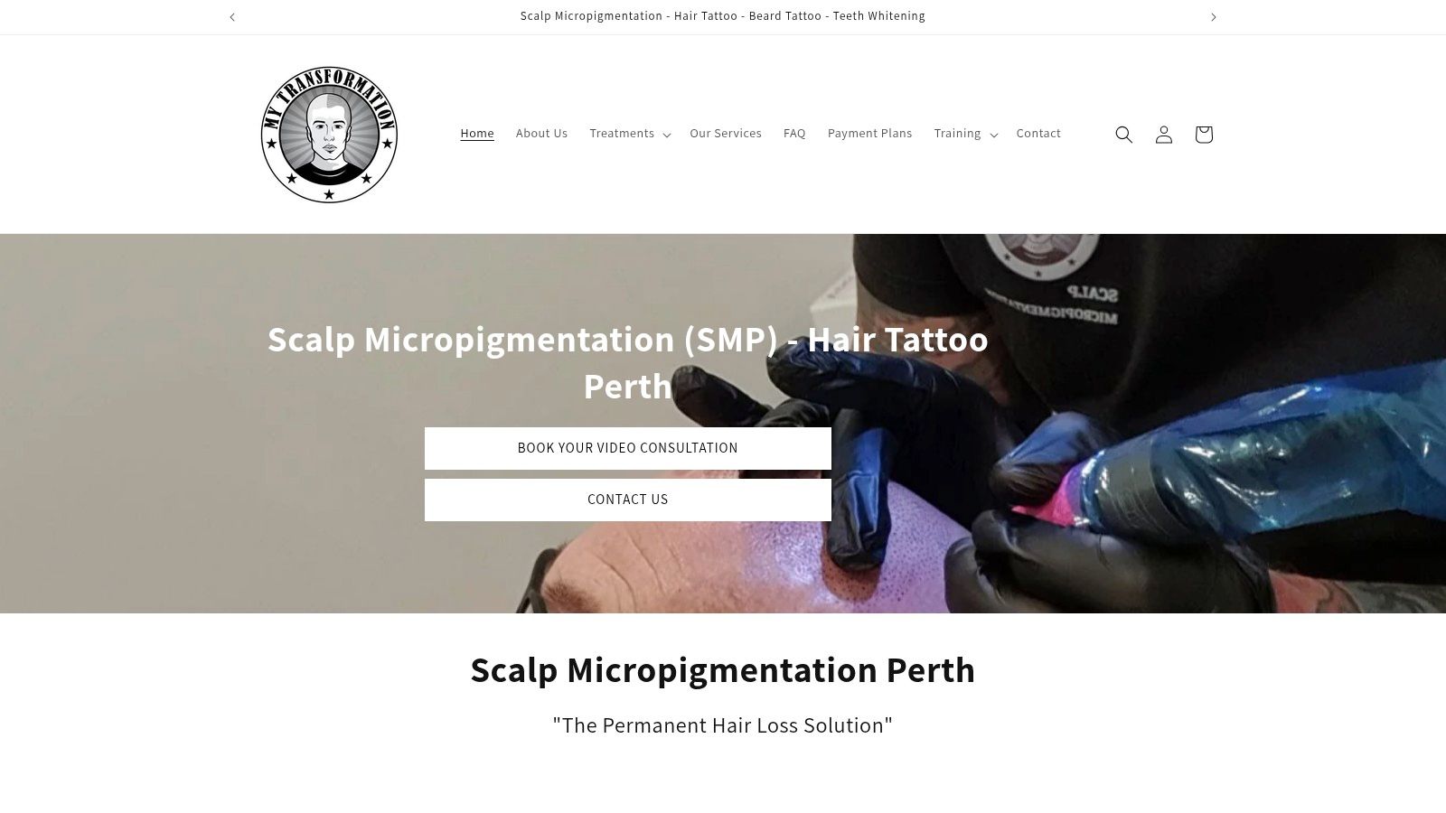 A before and after image showing the results of scalp micropigmentation on a man's scalp.