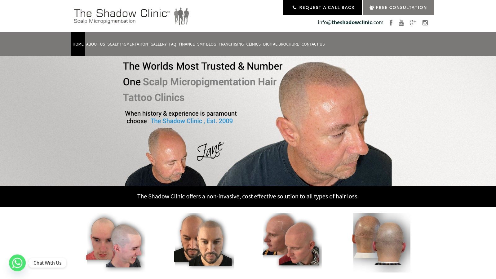 The Shadow Clinic website showing various before and after results for scalp micropigmentation