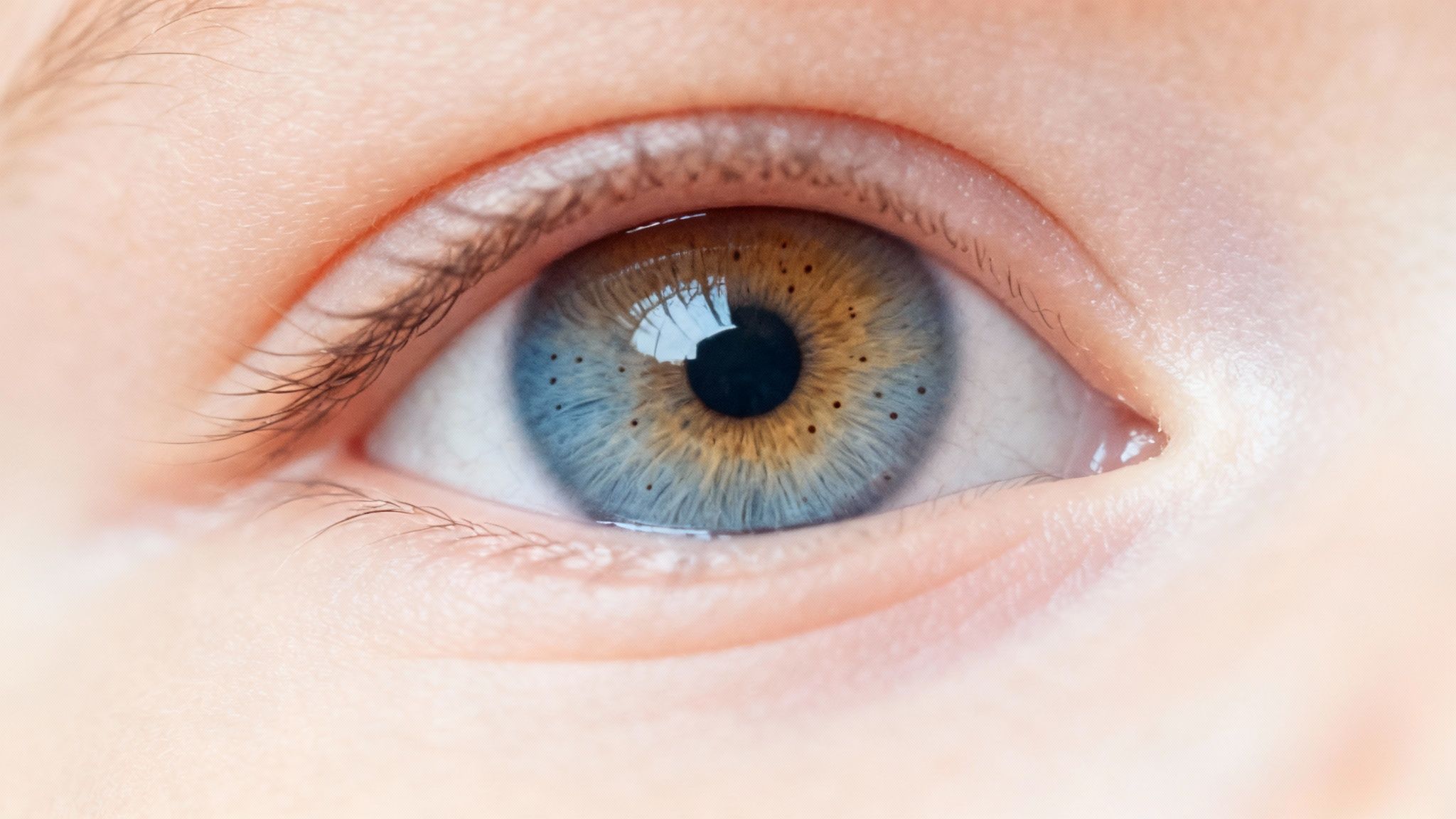 Close-up of human eye showing heterochromia with blue and brown iris color pattern