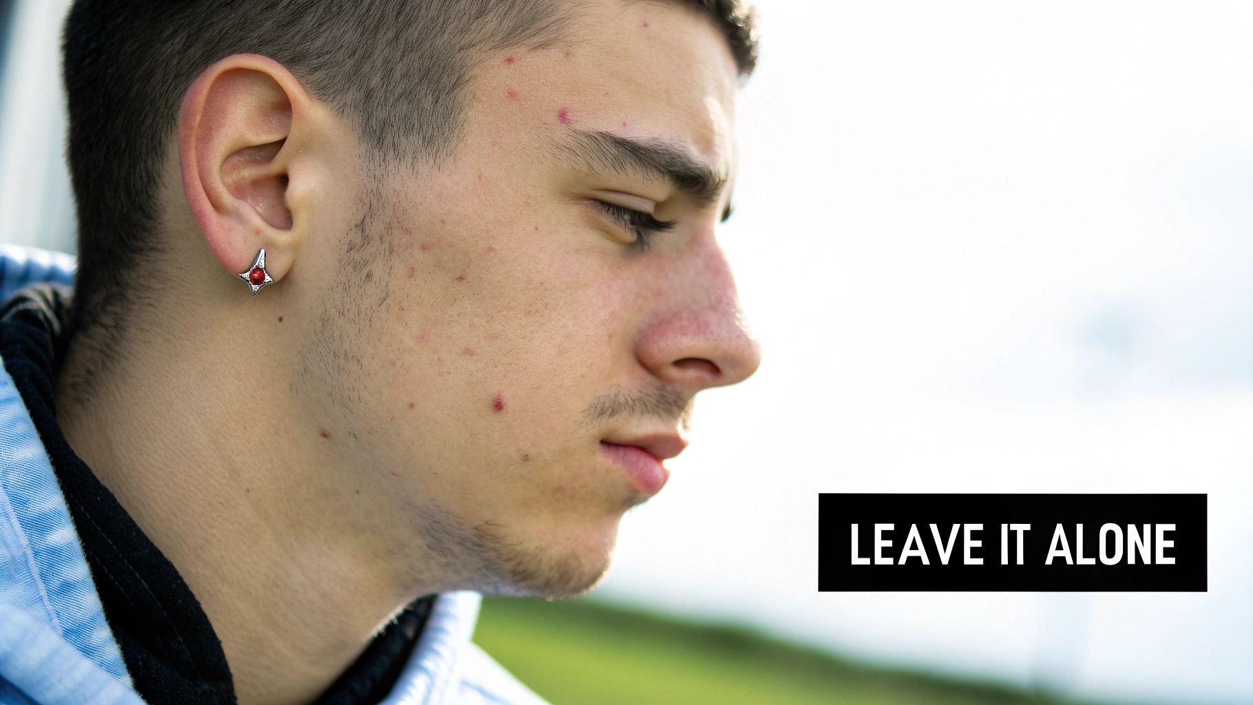 Close-up of a young man's face with acne, an earring, and text 'LEAVE IT ALONE'.