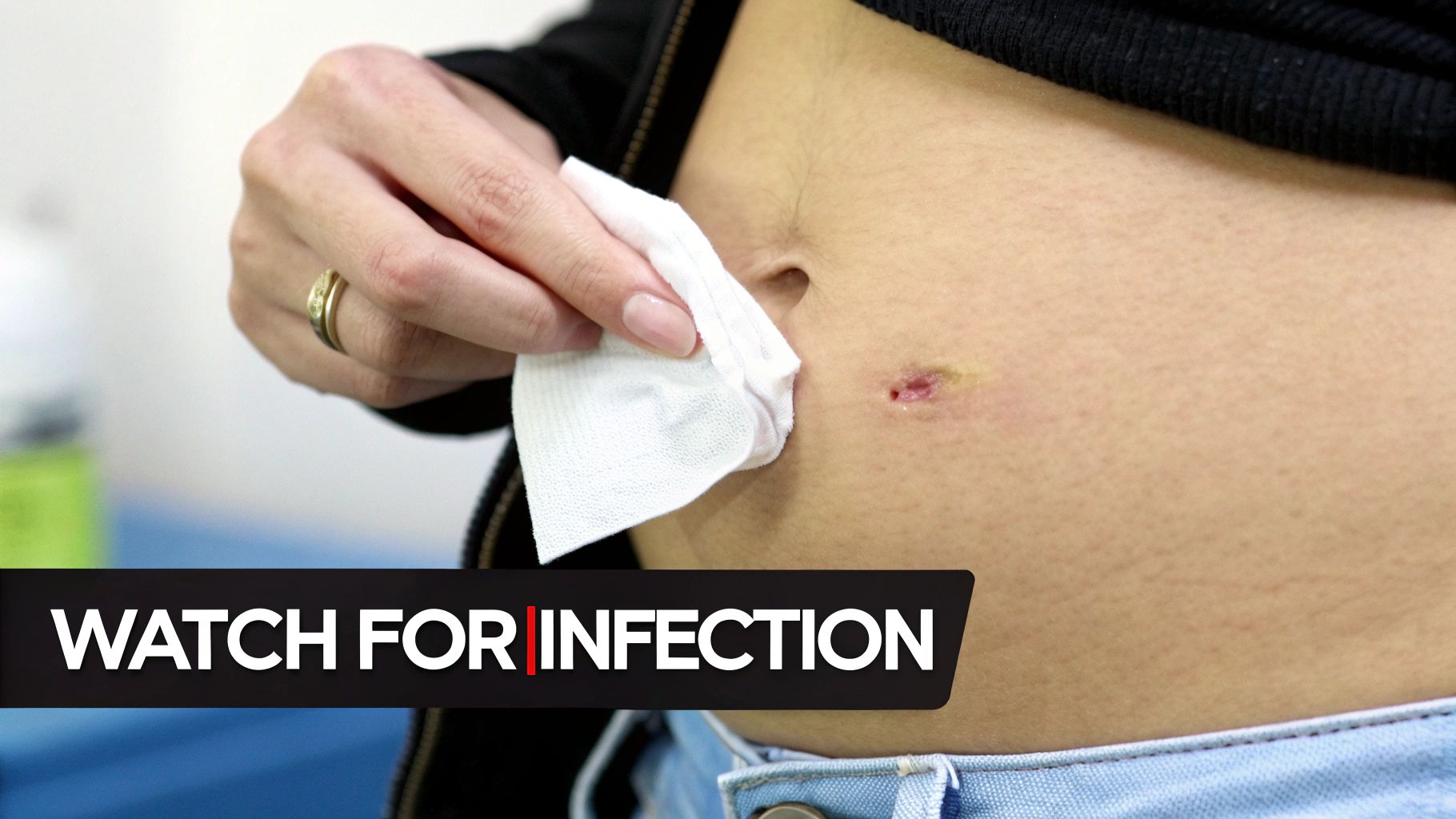 Close-up of a person cleaning a healing wound or piercing near the navel, with text 'Watch for Infection'.