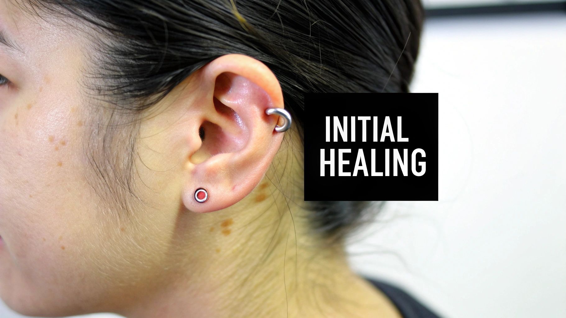 Close-up of a person's ear with earlobe and helix piercings during initial healing, showing a C-ring.