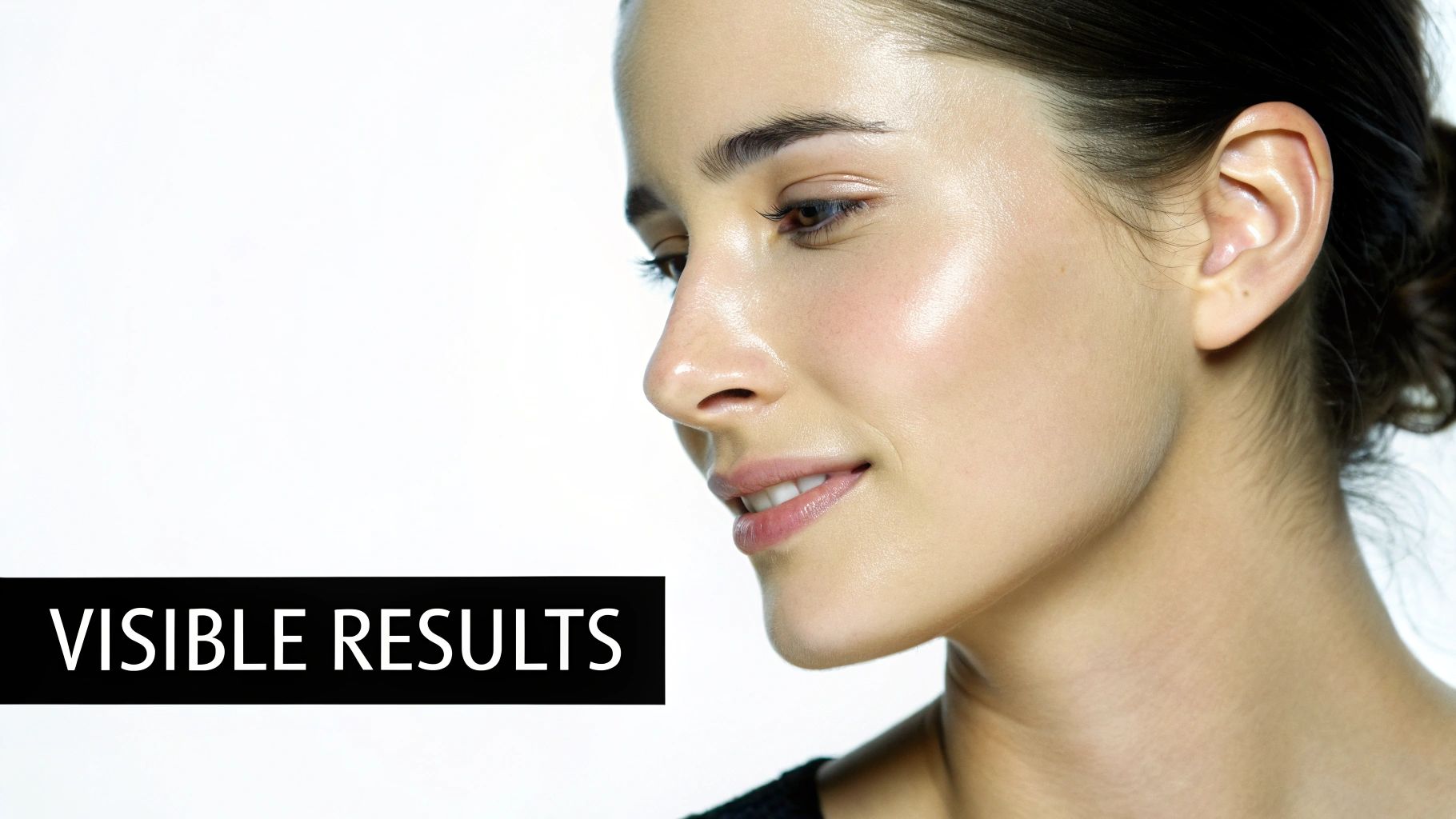 Before and After RF Microneedling with PRP Before and After RF Microneedling with PRP