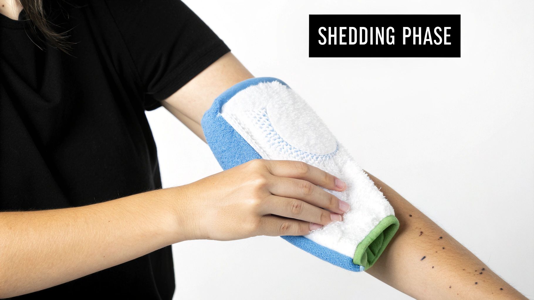 Person's arm being exfoliated with a blue and white mitt during the shedding phase.