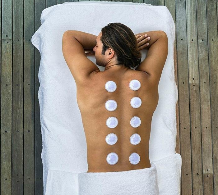 A man lies face down on a white towel, receiving cupping therapy on his bare back.