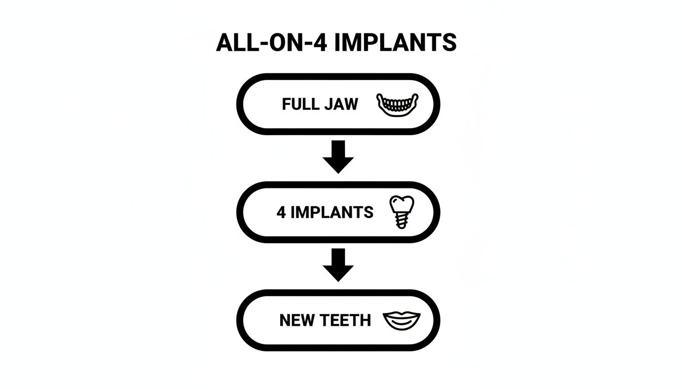Flowchart illustrating the All-on-4 dental implant process: full jaw to 4 implants, resulting in new teeth.