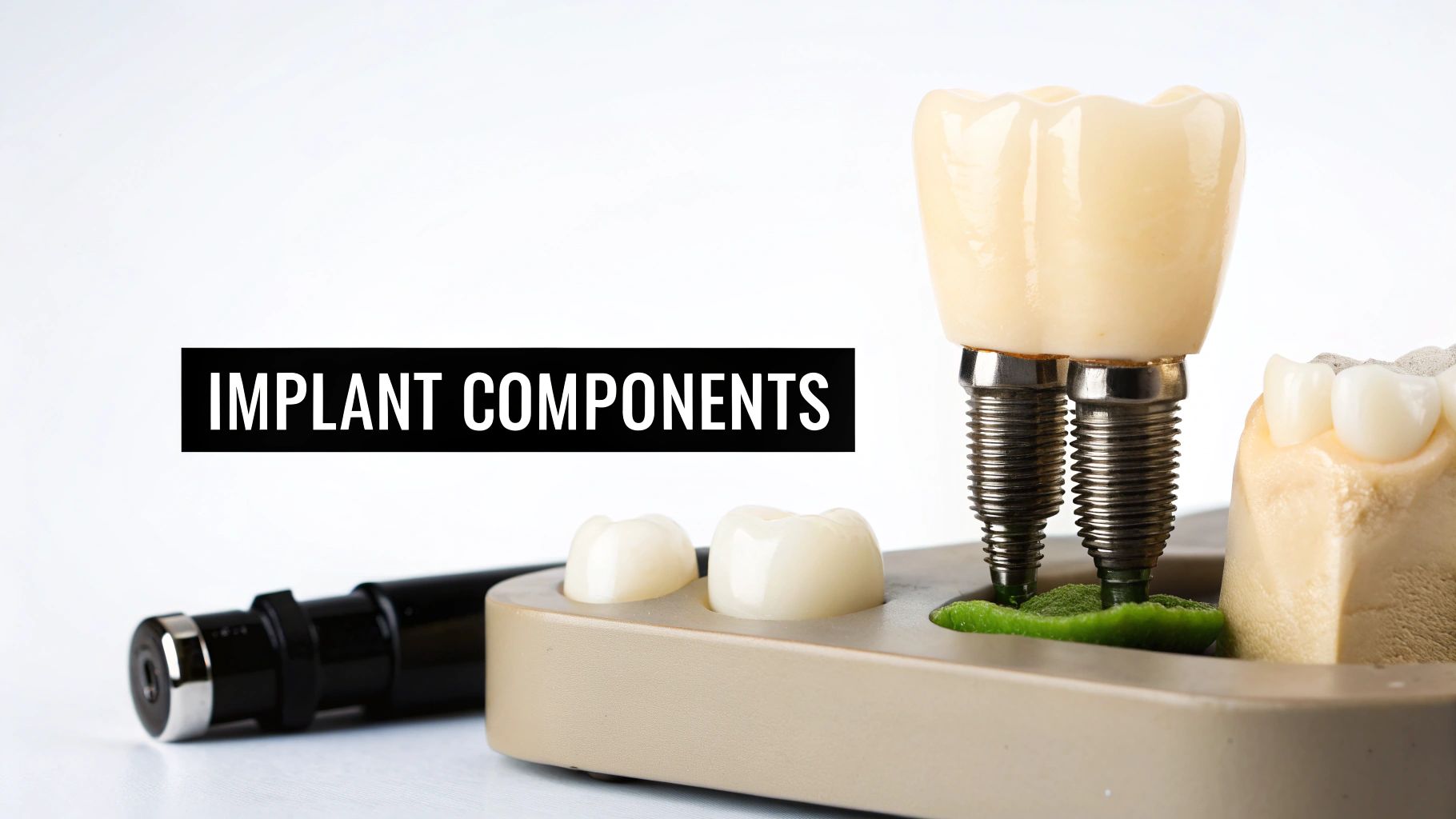 Close-up of dental implant components, including a crown, screws, and various dental models.