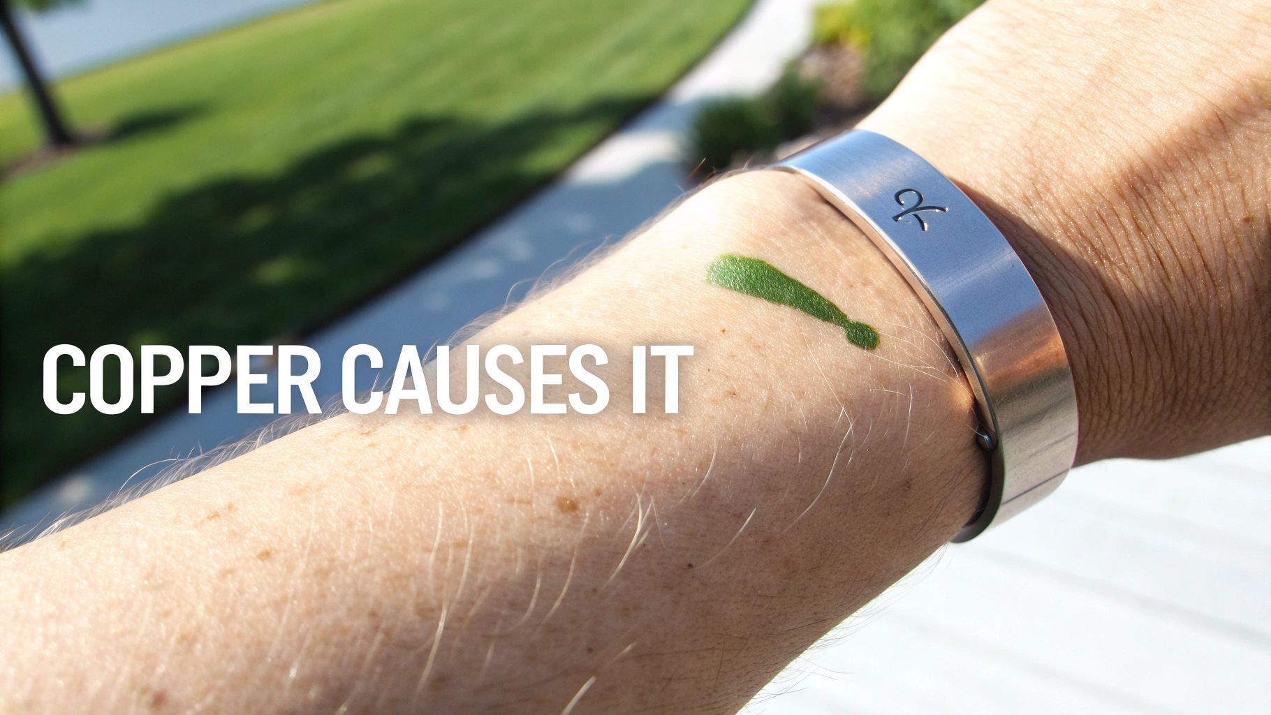 Close-up of an arm with a silver-colored bracelet, showing a green discoloration on the skin where the jewelry touched.